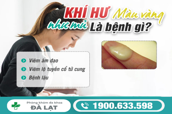 Hình ảnh minh họa